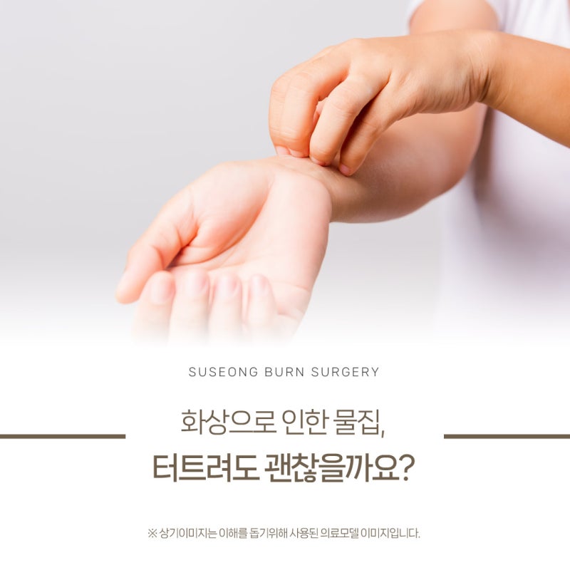 구미 칠곡 화상 물집이 생겼을 때, 적절한 처치 방법은?