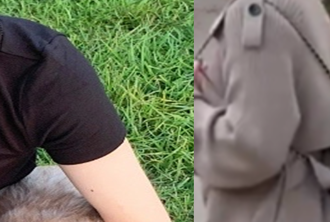 라라플랜 팔뚝살 해결 카티주사와 리프팅 후기 (내돈내산)