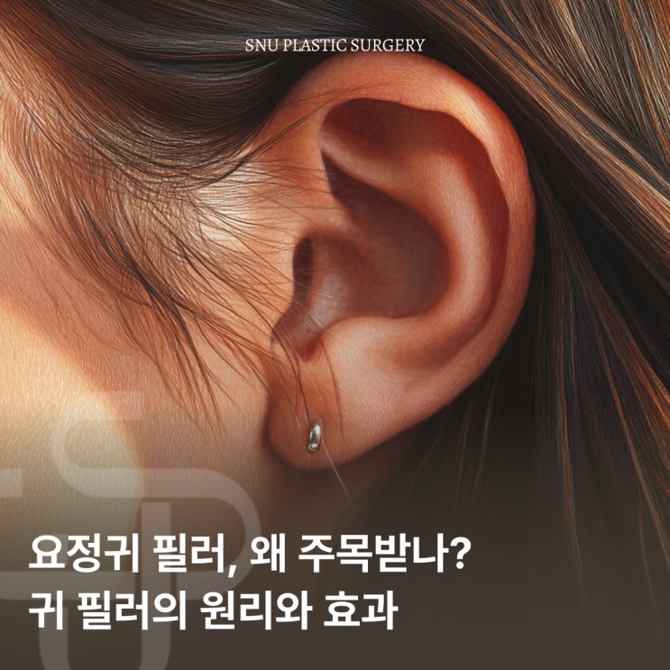  요정귀 필러, 자연스러운 얼굴 균형을 완성하는 방법
