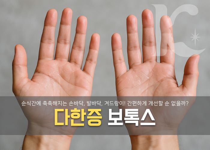  손 다한증 보톡스로 해결할 수 있을까 약 바르기 귀찮다면