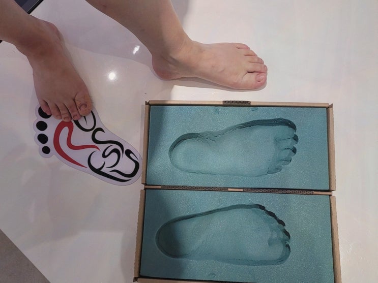  레푸스 천안두정점, 전문적인 발 관리를 위한 천안무좀발톱