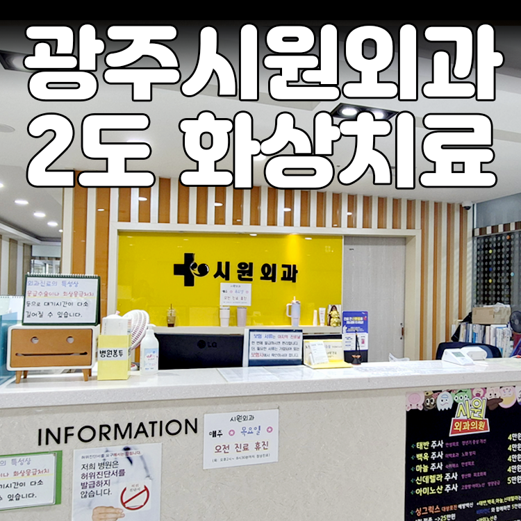 광주 시원외과 2도 화상 치료 끓는 물 화상