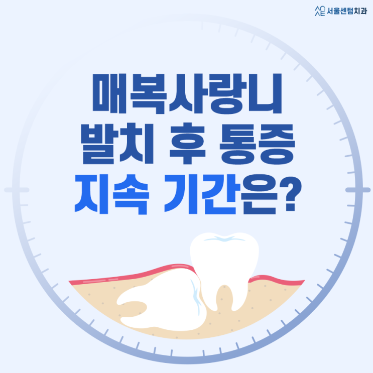  매복사랑니 발치통증 얼마나 지속될까?