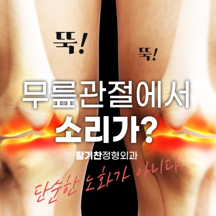  연신내정형외과, "뚝뚝" 소리 나는 무릎, 단순한 노화가 아니다