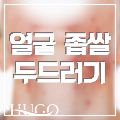 얼굴 좁쌀 두드러기가 나는 이유와 완화방법은