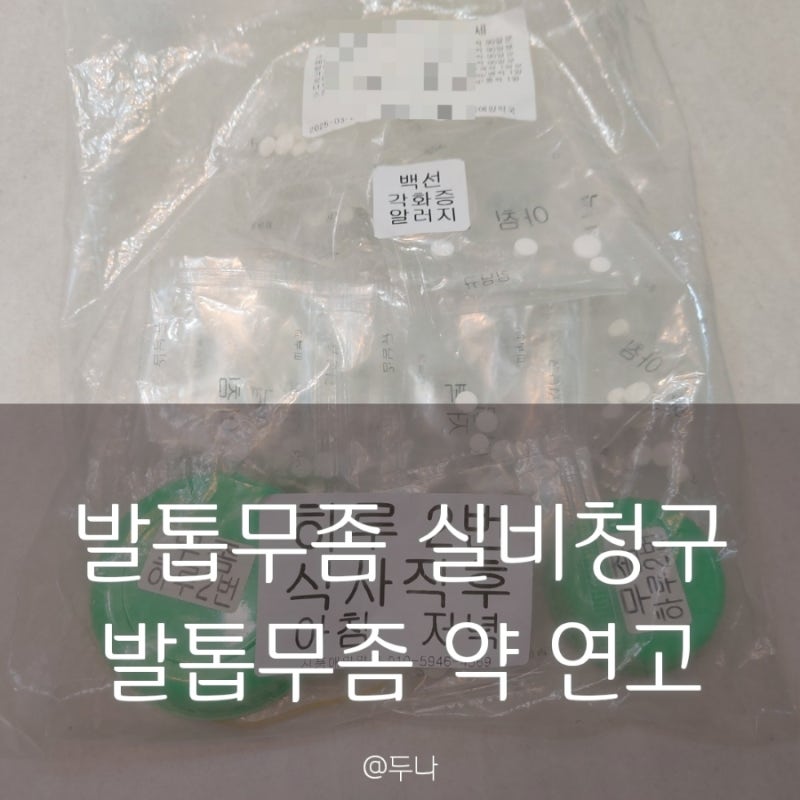 발톱무좀 의료 실비보험 청구 방법, 실비 서류, 질병코드 & 발톱무좀 약 연고 처방전