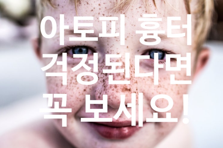  아이 아토피흉터 관리 완벽 가이드, 아토피 부모라면 필수!