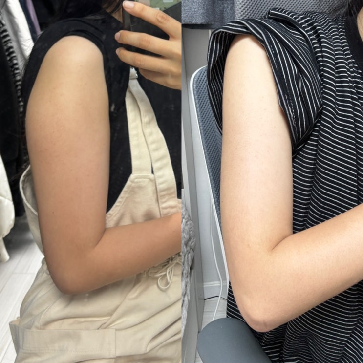  다가오는 여름은 날씬하게 보내보자! 건대피부과 찾는다면 "건대 닥터쁘띠의원"
