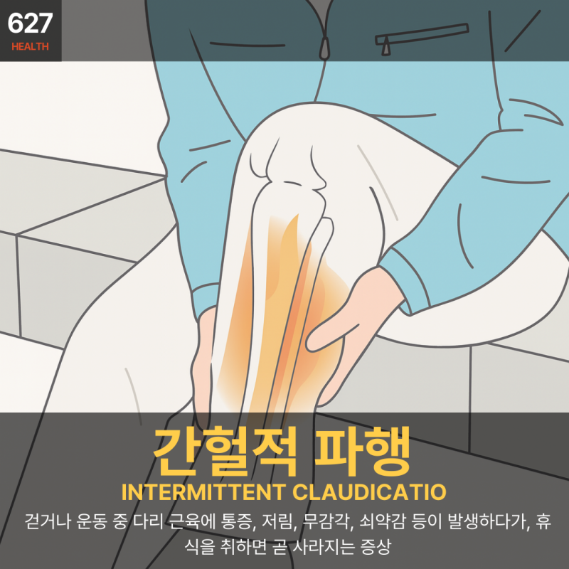 간헐적 파행(intermittent claudication) _ 걸을수록 다리가 아픈 이유, 7분만에 파악하기