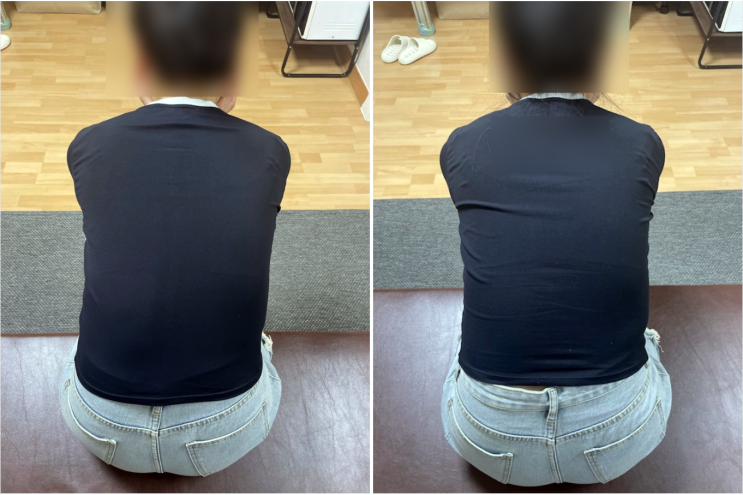  드투 전 드레스핏을 위한 구로 자세교정 윤샘 바른자세원 후기