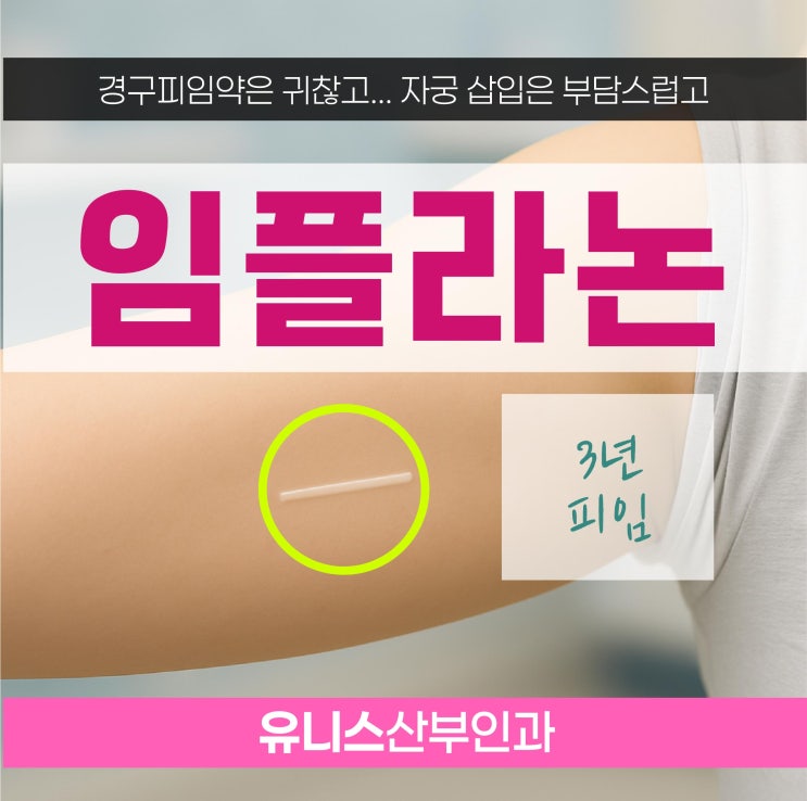  성수역임플라논, 피임 시술 나에게 맞는 방법을 찾고 싶을 때