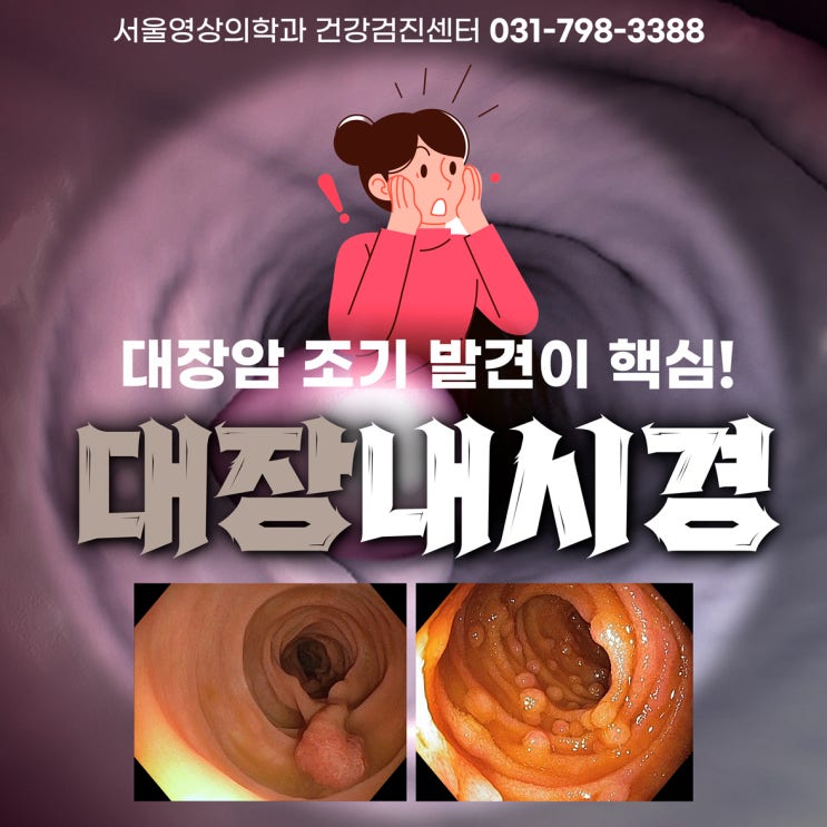  경기광주 대장내시경, 대장암 조기 발견이 핵심! (질문과 답변)