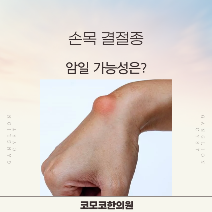  없어지지 않는 손목 혹, 손목 결절종 괜찮을까요? (원인, 증상, 한의원 치료까지)
