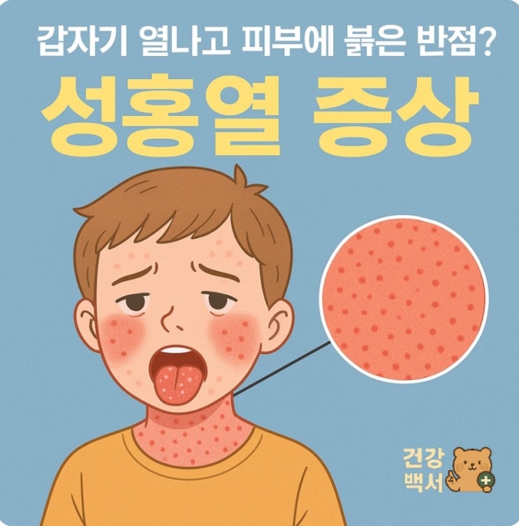  갑자기 열나고 피부에 붉은 반점? 성홍열 증상