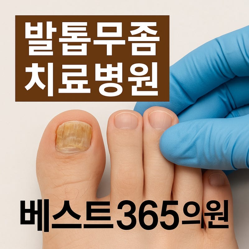 청주 발톱무좀, 그냥 두면 절대 안되는 이유와 치료법