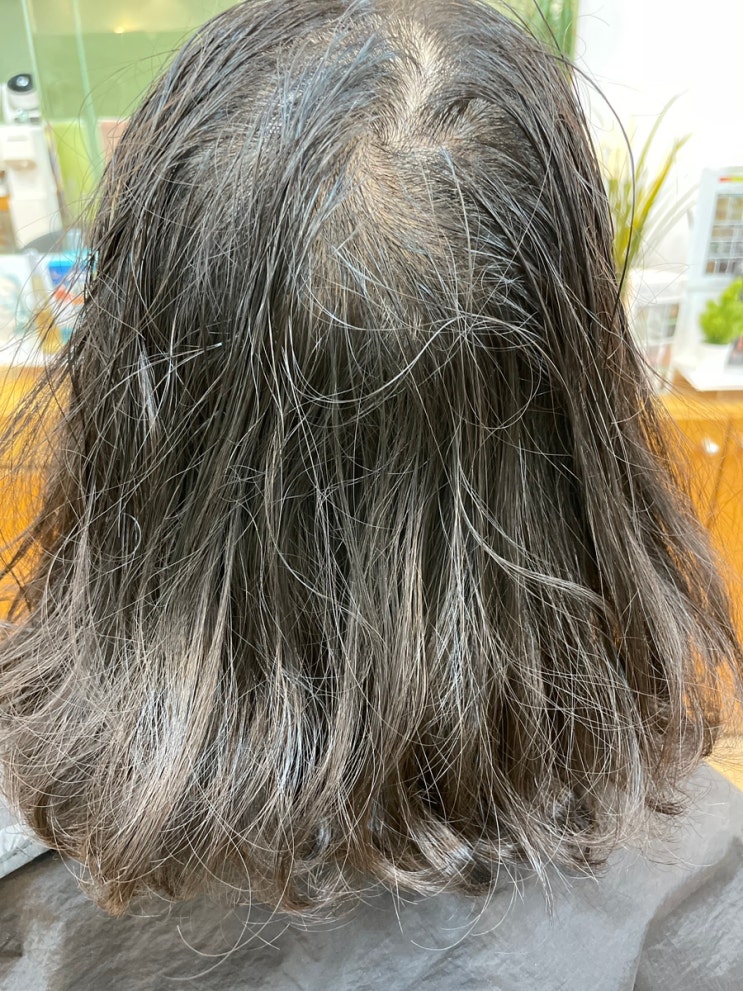  경남에서왔다구요?여성정수리심한탈모와모발손상그리고두피케어가필요해요 부산르네시떼미용실토탈케어출동!/ 경북남해거제마산창원진해진주밀양양산울산명지김해대저화명용원녹산경주대동주촌영도감만신항