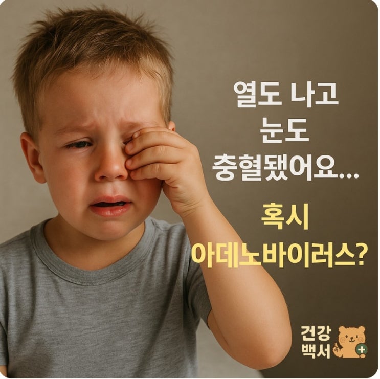  눈병과 고열, 아데노바이러스 증상일까?