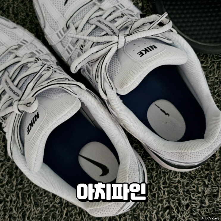  아치파인 편안한 아치 서포트 내돈내산 구입 후기