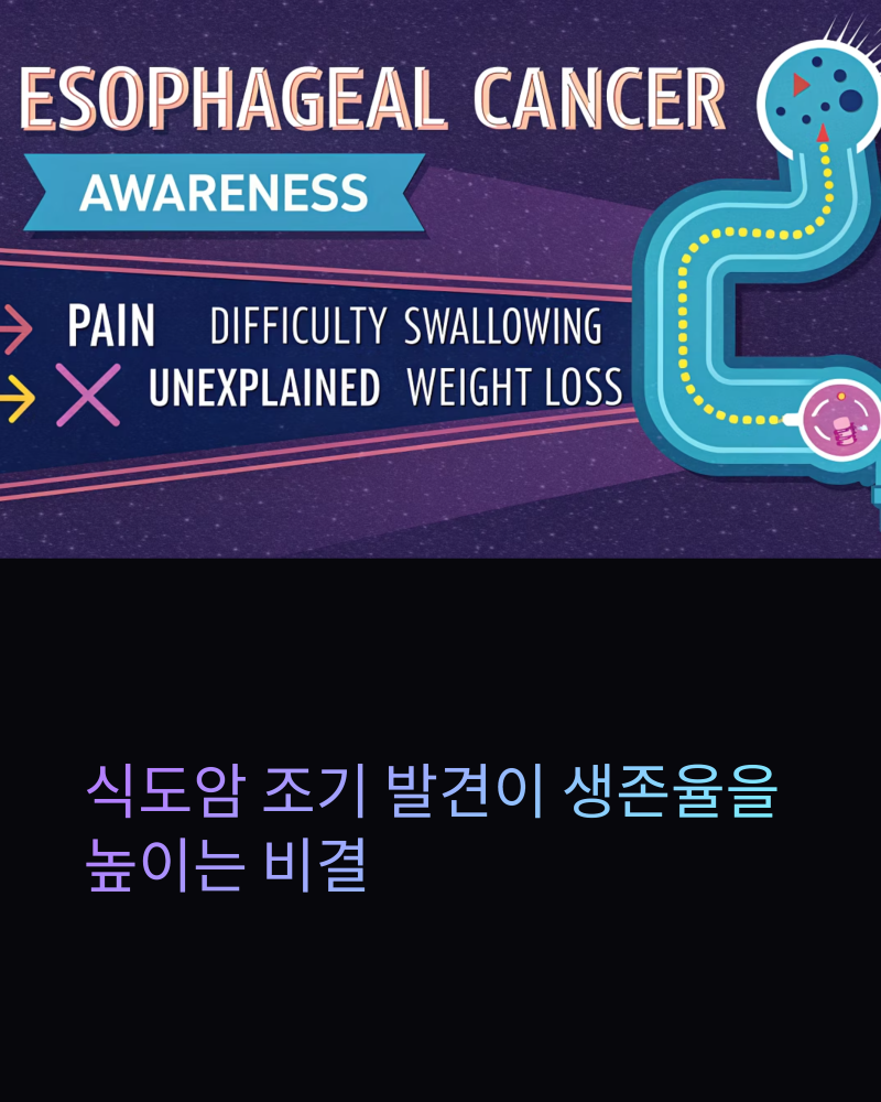 식도암 초기증상과 전이 생존율