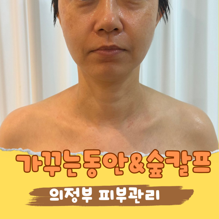  의정부작은얼굴관리 만족도 높았던 곳, 가꾸는동안&숲칼프 의정부 교육센터