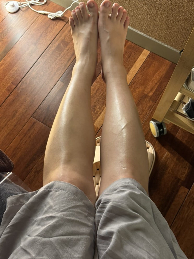  청담에스테틱 드림라인 후기 하체부기 톨레스 관리 전후비교