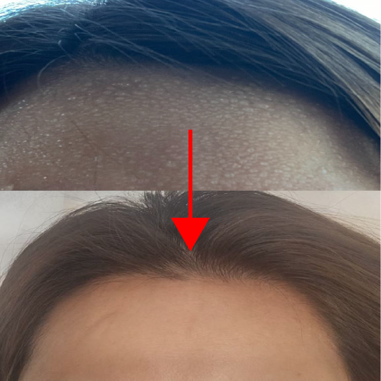  머리 땀 억제제 말고 생활습관으로 해결!