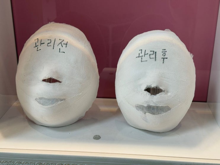  한 번의 케어로 맑아진 피부, 결혼 준비의 시작은 여기서부터 … 신내동에서 받은 특별한 신부관리 이야기