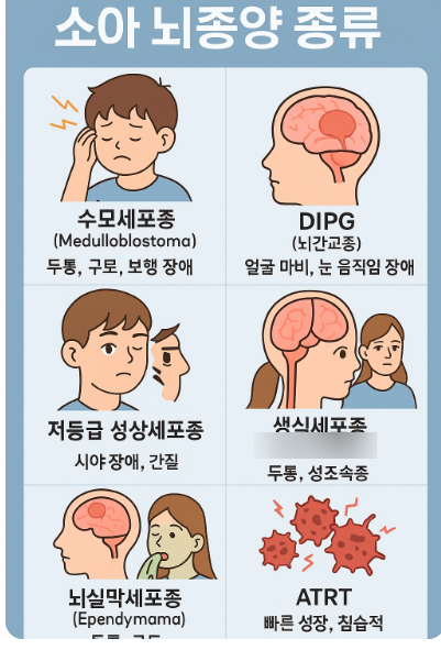 소아암 중 뇌종양이 가장 위험한 이유 – 위치별 증상과 진단법 총정리