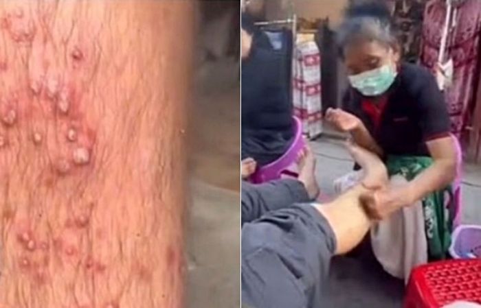  “7000원 마사지의 대가”…태국 골목길에서 벌어진 충격의 응급 사례
