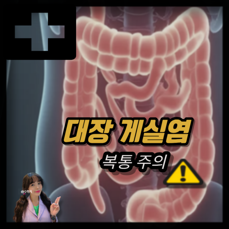  대장 게실염 증상 원인 치료, 게실염 초기증상