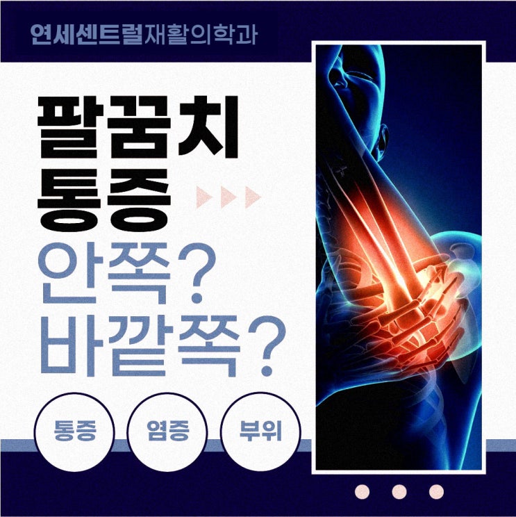  을지로3가정형외과, 팔꿈치통증 참지마세요