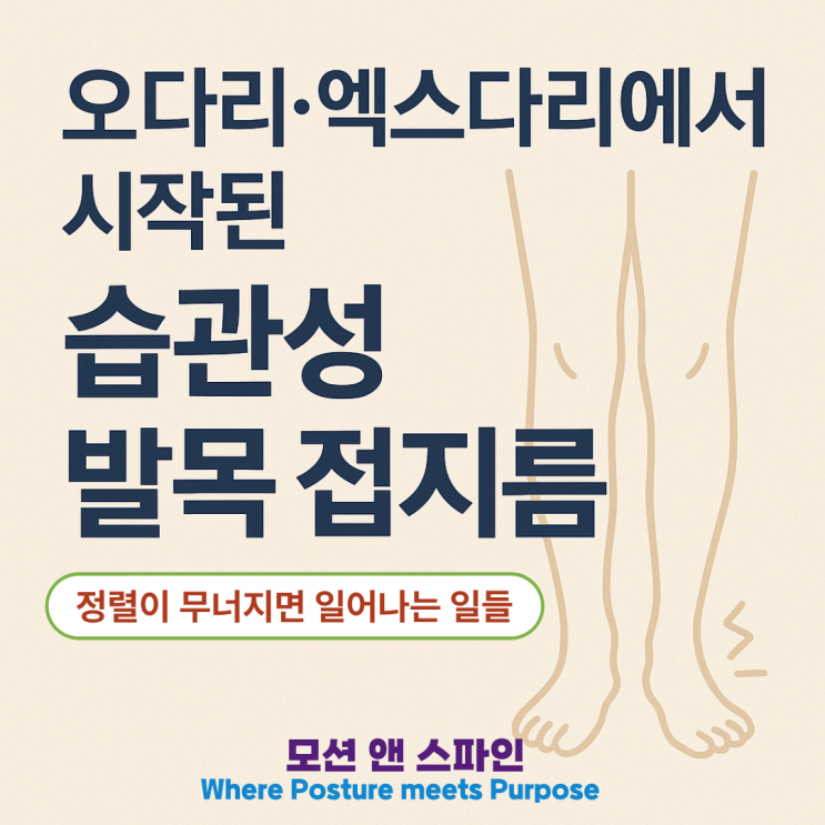  오다리·엑스다리에서 시작된 습관성 발목 접지름 – 정렬이 무너지면 생기는 일들
