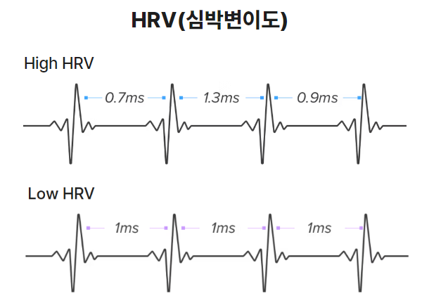 자율신경실조증 검사, 비용 가격 종류 병원 총정리