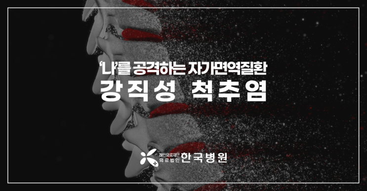  제주 류마티스내과_강직성척추염, 진단 늦어지면 안돼…허리통증 외 증상은?