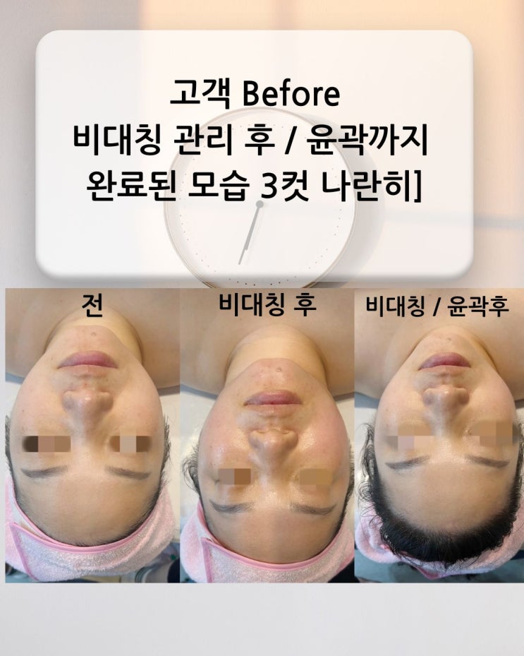  부산피부관리 - 안면비대칭 먼저 잡아야 윤곽이 산다! 동래피부관리 비본스킨앤바