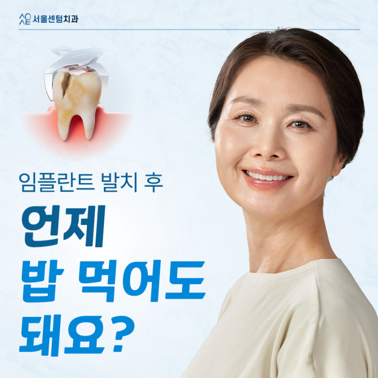  임플란트 발치후 식사 바로 가능할까요 식단 가이드 A to Z