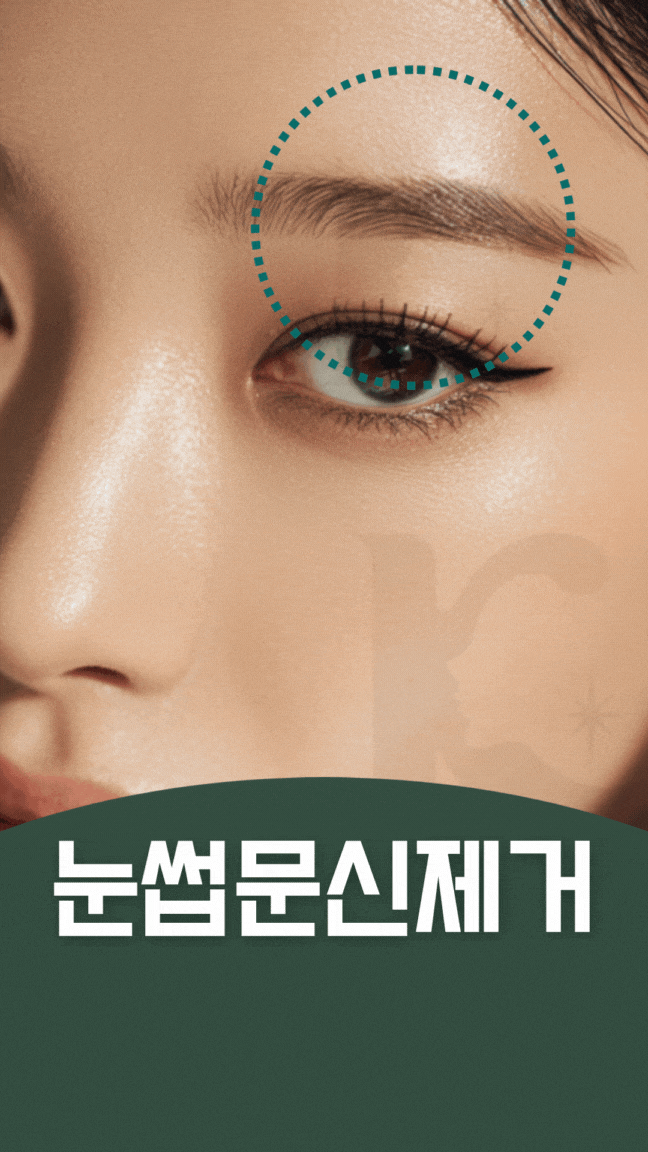  광주눈썹문신제거 수완지구에서 타투 지우기 전에 알아볼 것은