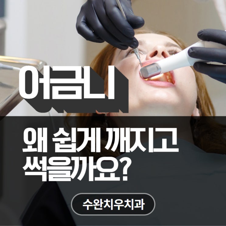  수완지구치과, 어금니가 썩었거나 깨진 경우 어떻게 해야