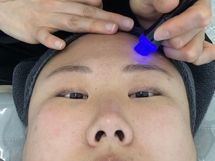  유분·모공 고민? 천안 피부관리샵 미우에스테틱 아쿠아필 리얼 후기!
