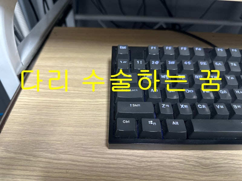 아찔한 다리수술하는꿈 재미난 꿈 해몽 이야기
