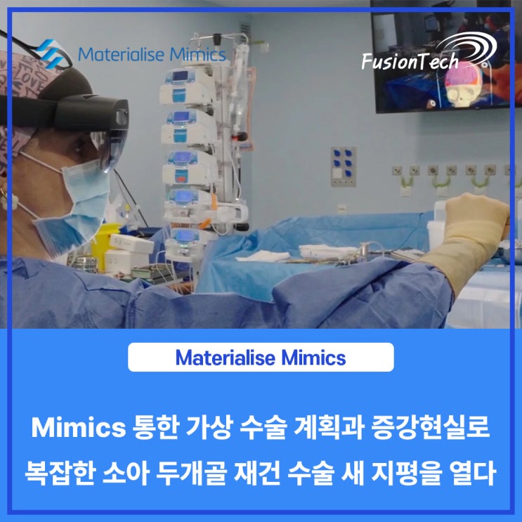  [Materialise S/W] Mimics 통한 가상 수술 계획과 증강현실로 복잡한 소아 두개골 재건 수술 새 지평을 열다