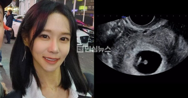 '나는 솔로' <b>16기 옥순</b>, <b>혼전임신</b> 고백…초음파 사진 공개 "남편... 