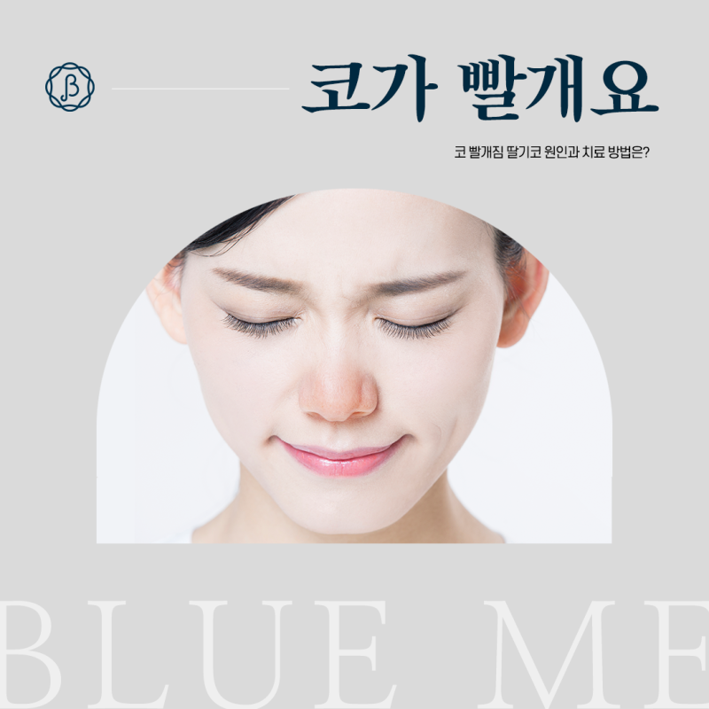 코가 빨개요 딸기코 코 빨개짐 원인 치료 방법은?
