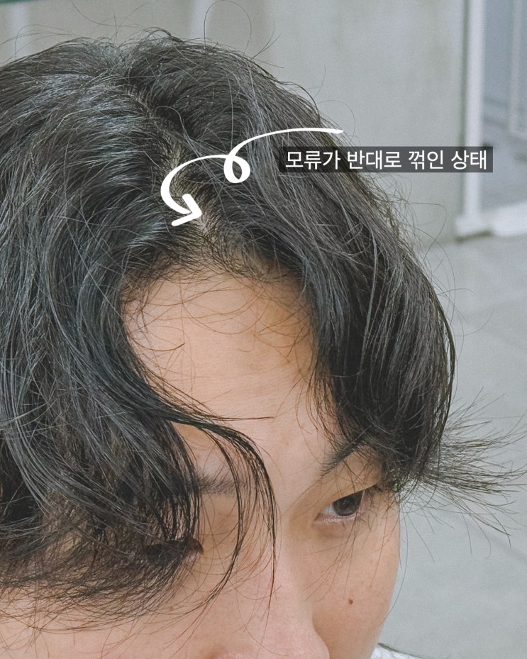  모류교정 가격, 시술시간, 유지기간, 관리법까지 핵심 요약!