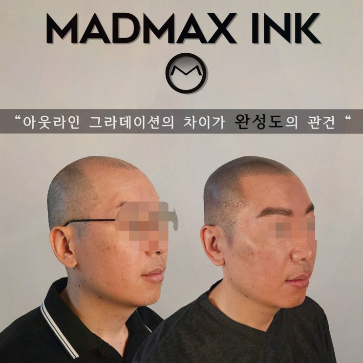  매드맥스잉크, 천안정수리탈모로 나의 자신감을 되찾다