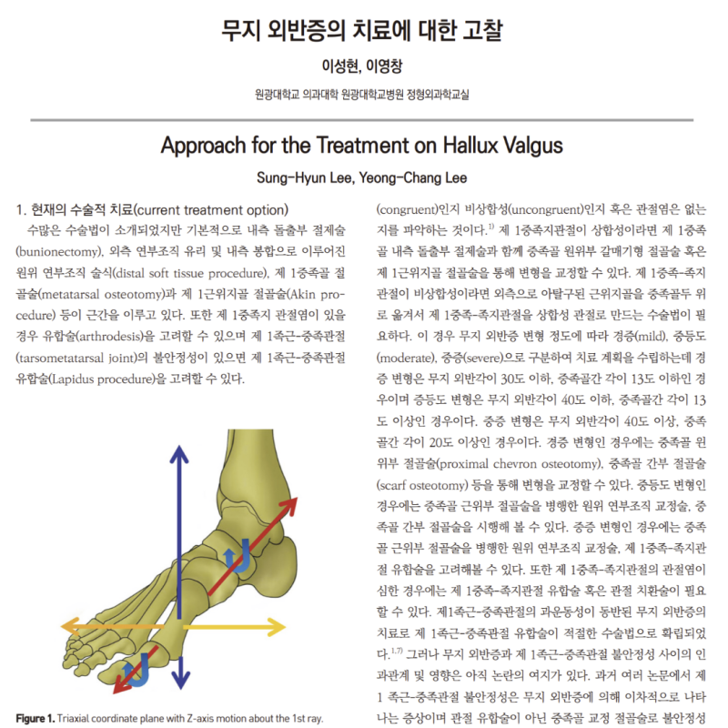 무지외반증 증상 깔창 교정 치료 병원 대구 수성구 재활의학과