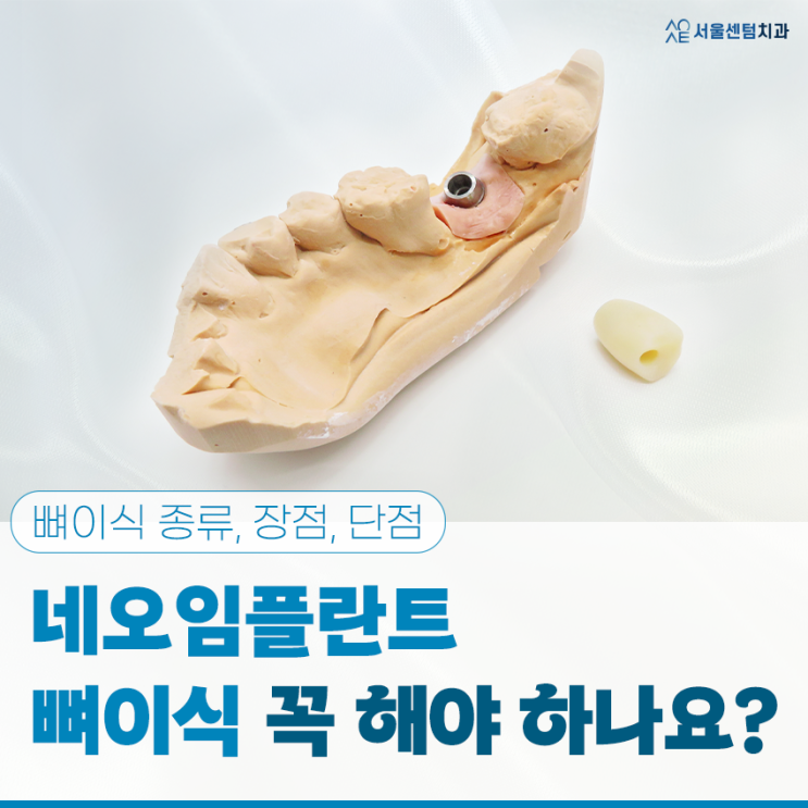  네오임플란트 뼈이식 꼭 해야할까?종류 장점 단점
