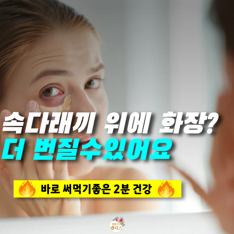 눈밑 속다래끼 화장으로 덮는 순간 악화될수도!