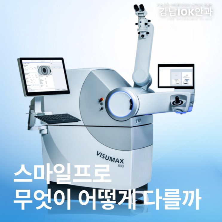  스마일라식 스마일프로, 강남에서 가장 인기 많은 이유는?