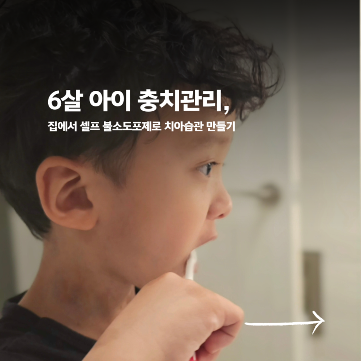  6살 아이 충치관리, 집에서 셀프 불소도포제로 치아습관 만들기